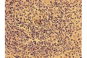 Immunohistochemistry of paraffin-embedded human spleen tissue using ABIN7149294 at dilution of 1:100 (IL2RG anticorps  (AA 75-230))