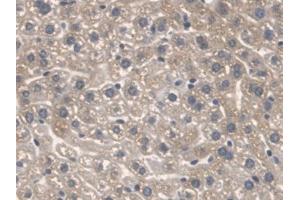 Detection of SPTLC1 in Mouse Liver Tissue using Polyclonal Antibody to Serine Palmitoyltransferase, Long Chain Base Subunit 1 (SPTLC1)
