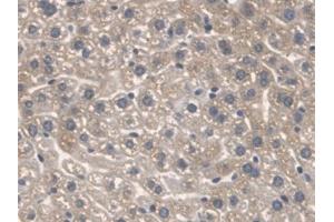 Detection of SPTLC1 in Mouse Liver Tissue using Polyclonal Antibody to Serine Palmitoyltransferase, Long Chain Base Subunit 1 (SPTLC1) (SPTLC1 anticorps  (AA 143-473))
