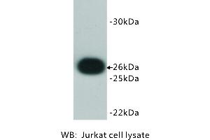 Image no. 3 for anti-B-Cell CLL/lymphoma 2 (BCL2) antibody (ABIN1112797)