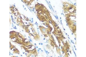 Immunohistochemistry of paraffin-embedded Human stomach using NME3 Polyclonal Antibody at dilution of 1:100 (40x lens). (NME3 anticorps)