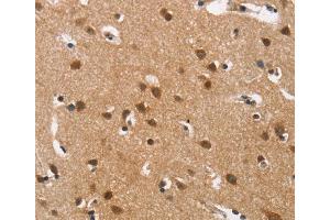 Immunohistochemistry (IHC) image for anti-Calcium Channel, Voltage-Dependent, L Type, alpha 1D Subunit (CACNA1D) antibody (ABIN5549743) (CACNA1D anticorps)