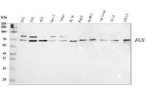 Western blot analysis of TLS/FUS using anti-TLS/FUS antibody (ABIN7603099).