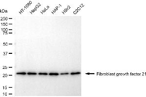 Western blotting analysis using fibroblast growth factor 21 antibody (ABIN7798605).