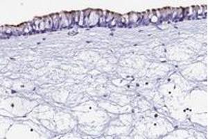 Immunohistochemical staining of human nasopharynx with TMEM117 polyclonal antibody  shows strong membranous positivity in respiratory epithelial cells. (TMEM117 anticorps)