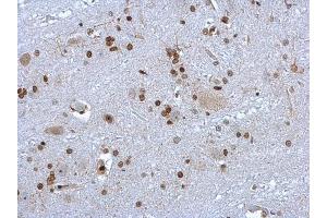 IHC-P Image HMGB1 antibody detects HMGB1 protein at nucleus on rat brain stem by immunohistochemical analysis. (HMGB1 anticorps)