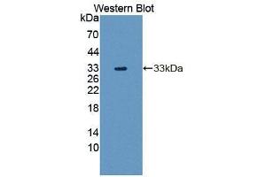 Western blot analysis of the recombinant protein. (TAT anticorps  (AA 221-454))