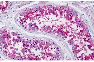 Human Testis: Formalin-Fixed, Paraffin-Embedded (FFPE)