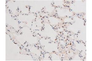 ABIN6267578 at 1/200 staining Rat lung170826 tissue sections by IHC-P.