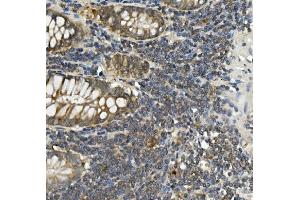 IHC analysis of Bid using anti-Bid antibody (ABIN7599062). (BID anticorps  (AA 1-195))