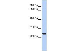 WB Suggested Anti-RPS7 Antibody Titration: 0. (RPS7 anticorps  (Middle Region))