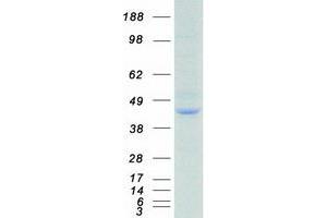 Validation with Western Blot