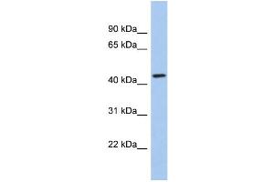 WB Suggested Anti-KCTD10 Antibody Titration:  0. (KCTD10 anticorps  (Middle Region))