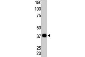 The PPP6C polyclonal antibody  is used in Western blot to detect PPP6C in Thymus tissue lysate. (PPP6C anticorps  (N-Term))