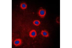 anti-Adenylate Cyclase 9 (ADCY9) (N-Term) antibody