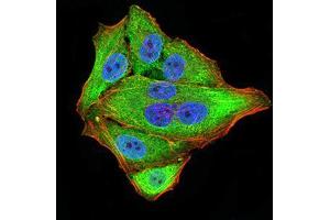 Immunocytochemistry (ICC) image for anti-Neurofilament Triplet M Protein (NEFM) (AA 779-916) antibody (ABIN5872897) (NEFM anticorps  (AA 779-916))