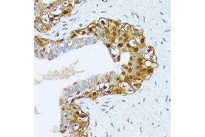 Immunohistochemistry of paraffin-embedded human breast using SMN1 antibody (ABIN7270652) at dilution of 1:100 (40x lens).