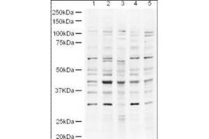 Western blot using  Affinity Purified anti-UBP43 antibody shows detection of a band ~43 kDa band (arrowhead) believed to be to UBP43 in lysates from HeLa nuclear extracts (lane 1) and whole cell lysates from HeLa (lane 2), A431 (lane 3, Jurkat (Lane 4) and HEK293 (lane 5). (USP18 anticorps  (AA 40-49))