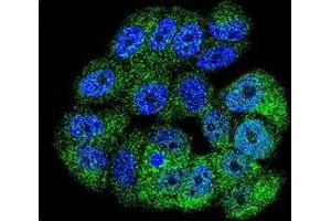 anti-C-Abl Oncogene 1, Non-Receptor tyrosine Kinase (ABL1) (AA 741-769) antibody