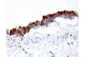 Immunohistochemistry using DAB substrate showing intense staining in the rat airway epithelium using AP1G1 polyclonal antibody  at a dilution of 1 : 500. (gamma 1 Adaptin anticorps  (AA 5-24))