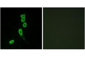 Immunofluorescence analysis of LOVO cells, using MSHR Antibody. (MC1 Receptor anticorps  (AA 268-317))
