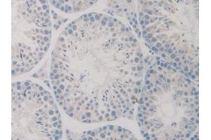 Detection of GDF5 in Mouse Testis Tissue using Polyclonal Antibody to Growth Differentiation Factor 5 (GDF5)