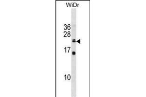 ISCU Antibody (C-term) (ABIN1881467 and ABIN2839004) western blot analysis in WiDr cell line lysates (35 μg/lane). (ISCU anticorps  (C-Term))