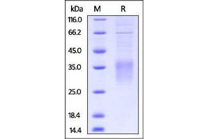 Mouse CD28, His Tag on SDS-PAGE under reducing (R) condition. (CD28 Protein (CD28) (AA 20-149) (His tag))