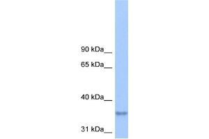WB Suggested Anti-LPPR2 Antibody Titration:  0. (LPPR2 anticorps  (Middle Region))