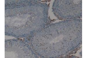 Detection of MX1 in Rat Testis Tissue using Polyclonal Antibody to Myxovirus Resistance 1 (MX1) (MX1 anticorps  (AA 68-303))