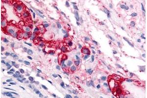 Human Pars Intermedia (formalin-fixed, paraffin-embedded) stained with CRHR1 antibody ABIN213513 at 20 ug/ml followed by biotinylated goat anti-rabbit IgG secondary antibody ABIN481713, alkaline phosphatase-streptavidin and chromogen.