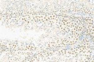 Immunohistochemistry analysis of paraffin-embedded mouse testis using,RPAP2 (ABIN7075481) at dilution of 1: 1000