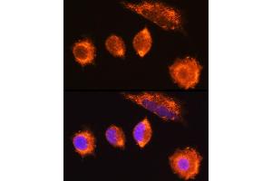Immunofluorescence analysis of L929 cells using MG Rabbit pAb (ABIN6132348, ABIN6143808, ABIN6143810 and ABIN6222011) at dilution of 1:100 (40x lens). (MGAT1 anticorps  (AA 156-445))