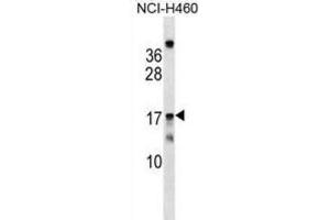 Western Blotting (WB) image for anti-Mitochondrial Ribosomal Protein S11 (MRPS11) antibody (ABIN2999548)