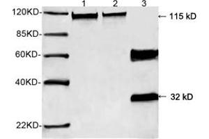 Western blot analysis of recombinant human Calcineurin A protein and mouse brain tissue lysate using 0. (Calcineurin A anticorps  (N-Term))