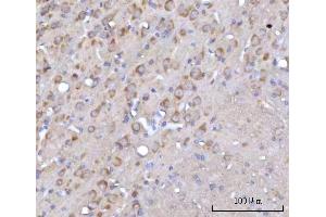IHC analysis of RARS/RARS1 using anti-RARS/RARS1 antibody (ABIN7600223). (Probable Arginine--tRNA Ligase, Cytoplasmic (RARS-1) (AA 165-425) anticorps)