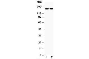 Western blot testing of Topoisomerase II alpha antibody and Lane 1:  HeLa;  2: Jurkat;  Predicted size: 174KD;  Observed size: 174KD (Topoisomerase II alpha anticorps  (C-Term))