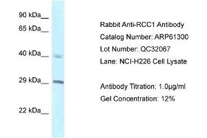 Western Blotting (WB) image for anti-Regulator of Chromosome Condensation 1 (RCC1) (C-Term) antibody (ABIN2788760) (RCC1 anticorps  (C-Term))