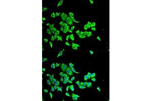 Immunofluorescence analysis of HeLa cells using SERPINB1 antibody.