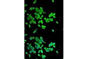 Immunofluorescence analysis of HeLa cells using SERPINB1 antibody. (SERPINB1 anticorps  (AA 100-379))