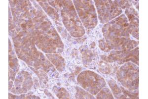 IHC-P Image Immunohistochemical analysis of paraffin-embedded SW480 xenograft, using Tropomyosin 2, antibody at 1:100 dilution.