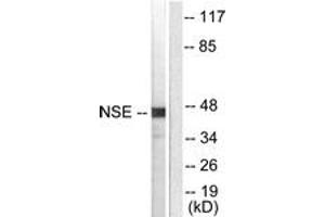 Western blot analysis of extracts from HepG2 cells, using NSE Antibody. (ENO2/NSE anticorps  (AA 371-420))