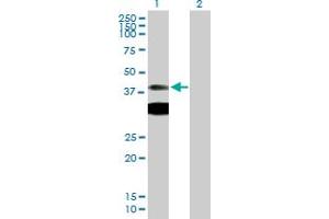 Western Blot analysis of PRKAR1A expression in transfected 293T cell line by PRKAR1A MaxPab polyclonal antibody. (PRKAR1A anticorps  (AA 1-381))