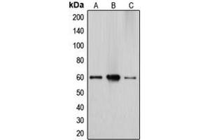 Western blot analysis of Cytochrome P450 27A1 expression in HepG2 (A), Caco2 (B), A549 (C) whole cell lysates. (CYP27A1 anticorps  (Center))