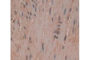 Figure. (MYH4 anticorps  (AA 1633-1875))