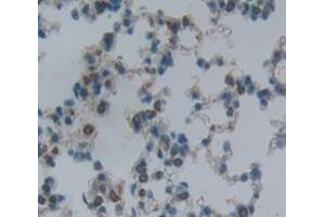 Used in DAB staining on fromalin fixed paraffin- embedded Kidney tissue