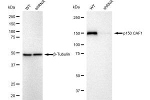 anti-Chromatin Assembly Factor 1, Subunit A (p150) (CHAF1A) antibody