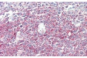 Detection of DDR2 in Human Tonsil Tissue using Polyclonal Antibody to Discoidin Domain Containing Receptor 2 (DDR2)