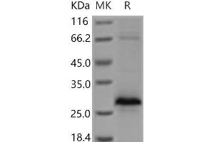 Western Blotting (WB) image for Ectodysplasin A2 Receptor (EDA2R) protein (His tag) (ABIN7321194)