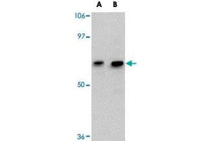 Western blot analysis of GALNT10 in SK-N-SH cell lysate with GALNT10 polyclonal antibody  at (A) 1 and (B) 2 ug/mL . (GALNT10 anticorps  (C-Term))